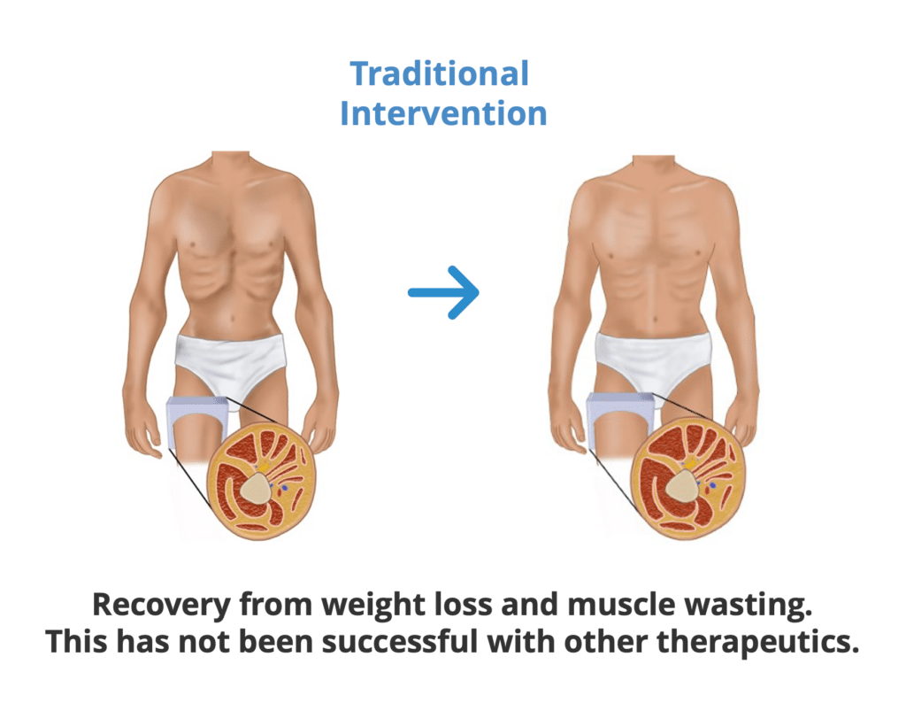 Traditional intervention for muscle recovery illustration.